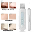 Ultrasonic Facial Scrubber - Aevanti